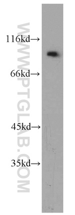 NBS1 Antibody in Western Blot (WB)