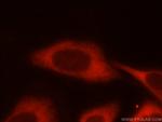 PFKM Antibody in Immunocytochemistry (ICC/IF)