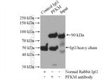PFKM Antibody in Immunoprecipitation (IP)