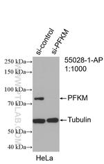 PFKM Antibody in Western Blot (WB)