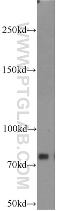 PFKM Antibody in Western Blot (WB)