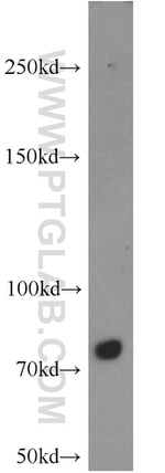 PFKM Antibody in Western Blot (WB)