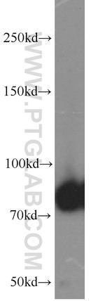 PFKM Antibody in Western Blot (WB)