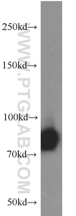 PFKM Antibody in Western Blot (WB)