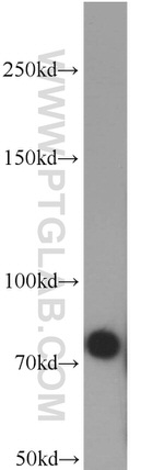 PFKM Antibody in Western Blot (WB)