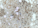 CDC25A Antibody in Immunohistochemistry (Paraffin) (IHC (P))