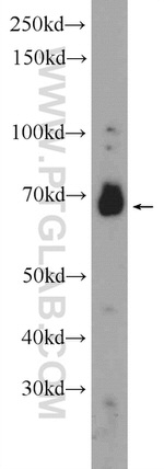 CDC25A Antibody in Western Blot (WB)