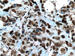 CDC25A Antibody in Immunohistochemistry (Paraffin) (IHC (P))