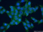 Syntaxin 2 Antibody in Immunocytochemistry (ICC/IF)