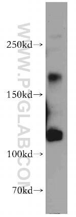 MAGI1 Antibody in Western Blot (WB)