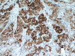 B3GALT6 Antibody in Immunohistochemistry (Paraffin) (IHC (P))