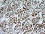 B3GALT6 Antibody in Immunohistochemistry (Paraffin) (IHC (P))