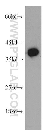 B3GALT6 Antibody in Western Blot (WB)
