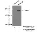 UNC13A/Munc13-1 Antibody in Immunoprecipitation (IP)