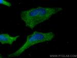 USP9X Antibody in Immunocytochemistry (ICC/IF)