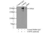 USP9X Antibody in Immunoprecipitation (IP)