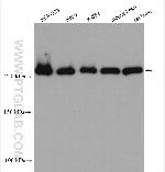 USP9X Antibody in Western Blot (WB)