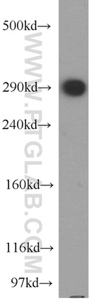 USP9X Antibody in Western Blot (WB)