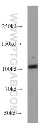 DLGAP3 Antibody in Western Blot (WB)