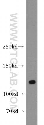 DLGAP3 Antibody in Western Blot (WB)