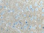 ADCY1 Antibody in Immunohistochemistry (Paraffin) (IHC (P))