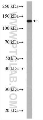 ADCY1 Antibody in Western Blot (WB)