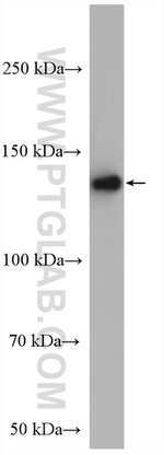 ADCY1 Antibody in Western Blot (WB)