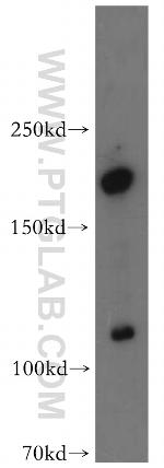 ADCY1 Antibody in Western Blot (WB)