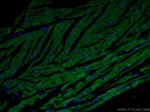 MTCO2 Antibody in Immunohistochemistry (PFA fixed) (IHC (PFA))