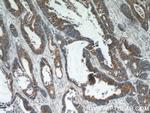 MTCO2 Antibody in Immunohistochemistry (Paraffin) (IHC (P))