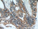 MTCO2 Antibody in Immunohistochemistry (Paraffin) (IHC (P))