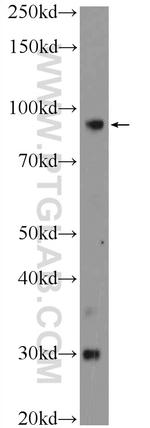 PLA2G4B Antibody in Western Blot (WB)