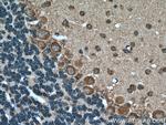 MTCO3 Antibody in Immunohistochemistry (Paraffin) (IHC (P))