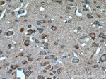 MTCO3 Antibody in Immunohistochemistry (Paraffin) (IHC (P))