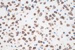 DRD2 Antibody in Immunohistochemistry (Paraffin) (IHC (P))