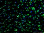 DRD2 Antibody in Immunohistochemistry (PFA fixed) (IHC (PFA))