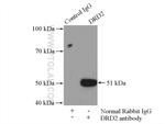 DRD2 Antibody in Immunoprecipitation (IP)