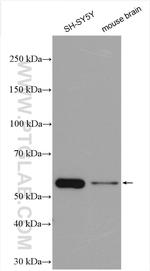 DRD2 Antibody in Western Blot (WB)