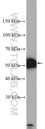 DRD2 Antibody in Western Blot (WB)