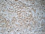 PRDX3 Antibody in Immunohistochemistry (Paraffin) (IHC (P))