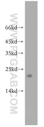 PRDX3 Antibody in Western Blot (WB)