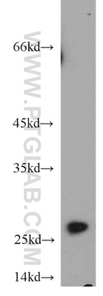 PRDX3 Antibody in Western Blot (WB)