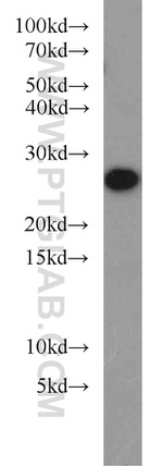 PRDX3 Antibody in Western Blot (WB)