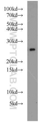 PRDX3 Antibody in Western Blot (WB)