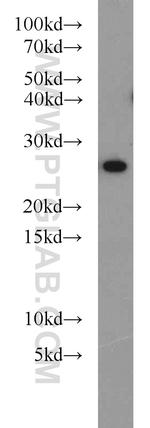 PRDX3 Antibody in Western Blot (WB)