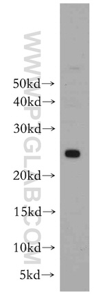 PRDX3 Antibody in Western Blot (WB)