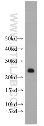 PRDX3 Antibody in Western Blot (WB)