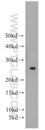 PRDX3 Antibody in Western Blot (WB)