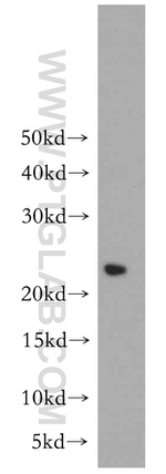 PRDX3 Antibody in Western Blot (WB)