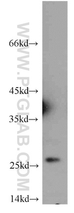 PRDX3 Antibody in Western Blot (WB)